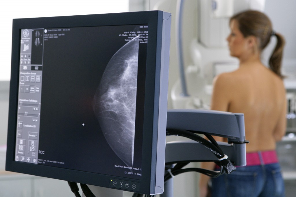 mammography-phuong-phap-phat-hien-som-ung-thu-vu-2
