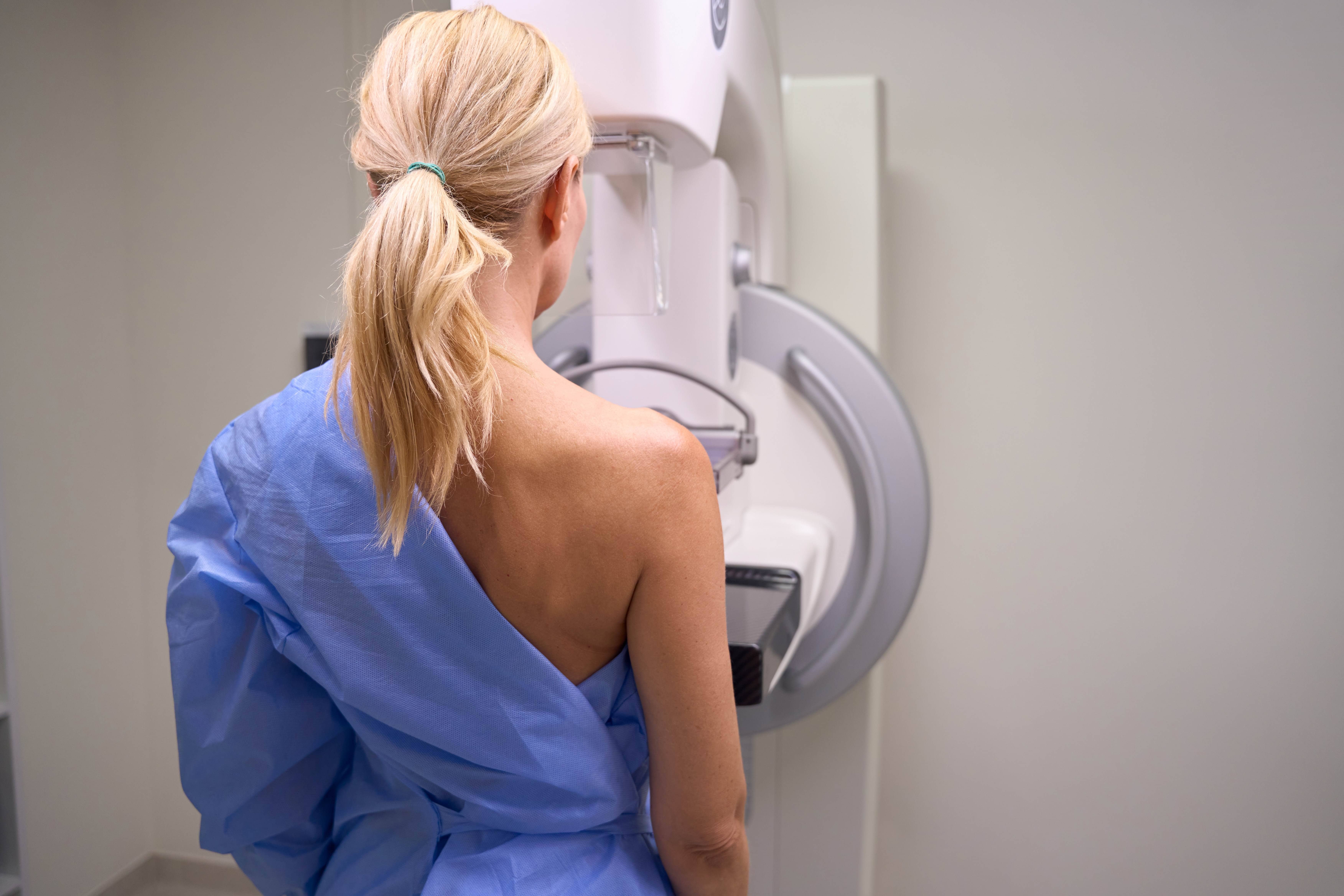mammography-phuong-phap-phat-hien-som-ung-thu-vu-1
